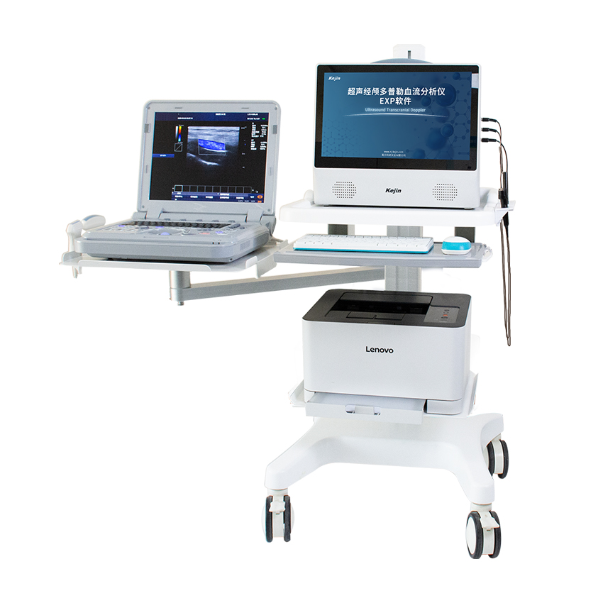 經(jīng)顱多普勒血管超聲解決方案